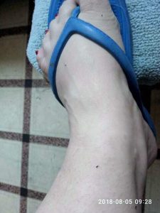 “Нас сьедают блохи!”