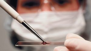 С лета в Украине можно будет бесплатно делать тесты на рак