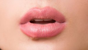 В Украине запретили популярный препарат от герпеса