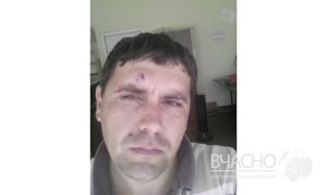 «Крышуют незаконную вырезку металла и бьют за это» – житель Краматорска об избиении полицейскими