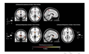 Исследование: мозг творческих людей мешает им зарабатывать
