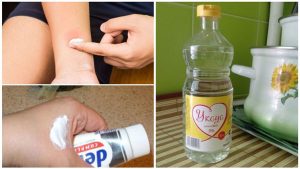 Лечение укусов насекомых народными средствами