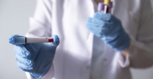 Встигли проконтактувати з певною кількістю людей: у Слов’янську виявлені ще два хворих чоловіки