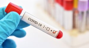 Не був у далеких поїздках: на COVID-19 захворів мешканець Слов’янська