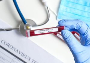 В Славянске COVID-19 инфицировано 37 человек