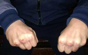 Напав у парку: краматорчанин згвалтував безпорадну дівчину