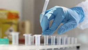 З 1 вересня у Донецькій області відкриються дві нові лабораторії для проведення ПЛР-тестування