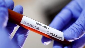 У Краматорську планують робити тести на коронавірус