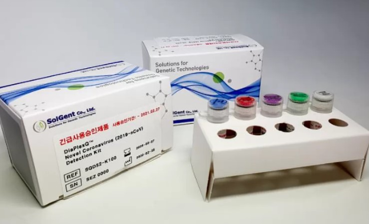 Кому делают бесплатные ПЦР-тесты на коронавирус: объяснение МОЗ