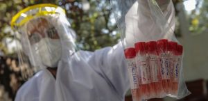 Коронавирусом можно заразиться во второй раз: кто в группе риска и насколько опасен “рецидив”