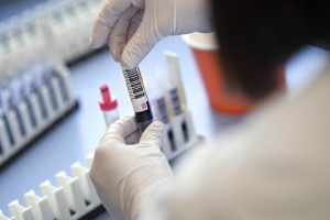 На Донеччині з початку пандемії зафіксовано три випадки смерті медичних працівників від COVID-19