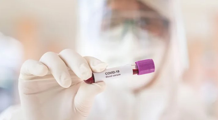 У 90% пациентов с COVID-19 нет контрольных симптомов, – британские ученые