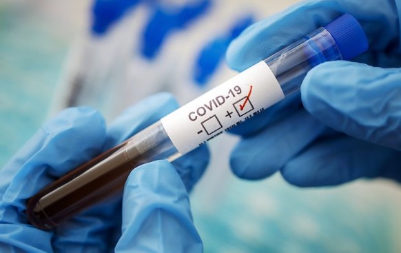 Очередной антирекорд… В Украине выявлено 7517 новых случаев COVID-19