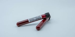 В Украине появится препарат на основе плазмы доноров для лечения коронавируса