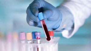 7 фактів, які вам варто знати про свою групу крові