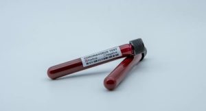 Экспресс-тестирование на антиген коронавируса на КПВВ при прибытии из Крыма и ОРДЛО будет бесплатным, — Ляшко