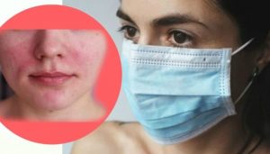 Как защитить кожу под маской: все, что нужно знать о масочных проблемах