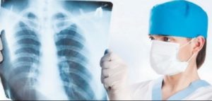 Врач предупредил о вспышке туберкулеза из-за карантина в Украине