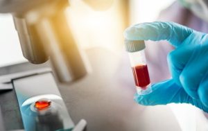 Тесты на антитела к COVID-19 – стоит ли их делать