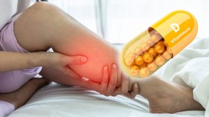 Признаком дефицита витамина D оказалось необычное ощущение в ногах