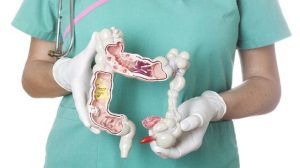 Как вылечить геморрой?