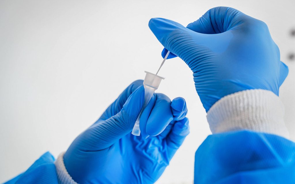 В Украине впервые обнаружили штамм “Омикрон”