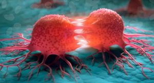 Топ-5 отличий доброкачественных опухолей от рака