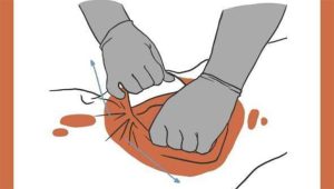 В Украине запущено приложение для оказания первой помощи