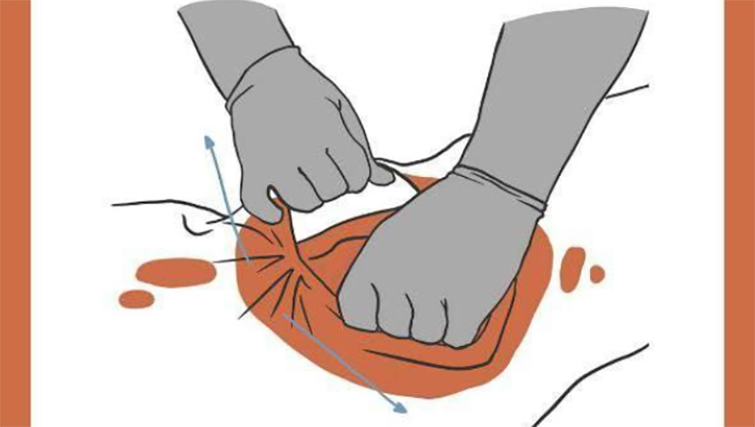 В Украине запущено приложение для оказания первой помощи