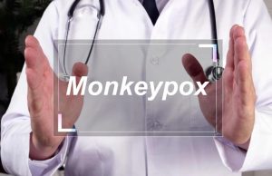 Мавпяча віспа 2022: симптоми, рекомендації ВООЗ