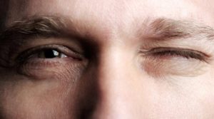 Підморгування чи нервовий тик? Про що сигналить “око, що смикається”