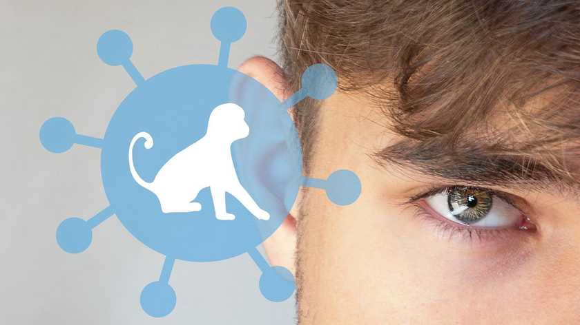 В Україні зареєстрували новий випадок віспи мавп: висип у пацієнта з’явився ще у серпні