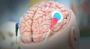 Ілону Маску дозволили експерименти з чіпами на живих людях, – BBC