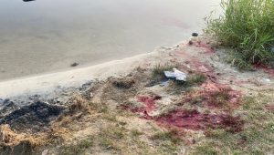 У лікарні померла дівчинка 2011 року народження, яку вчора поранили у Костянтинівці