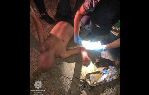 Патрульні надали домедичну допомогу травмованому чоловіку