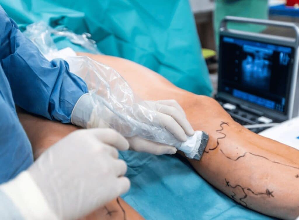 У Краматорську 22-25 листопада відбудуться безкоштовні консультації судинних хірургів з Києва. Як записатись