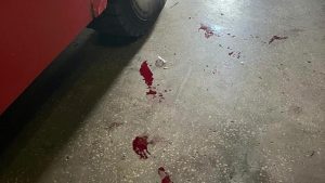 Атака на пожежну частину Донеччини: поранено 4 рятувальників
