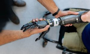 Безкоштовне протезування в Україні: як отримати сучасний виріб за державні кошти